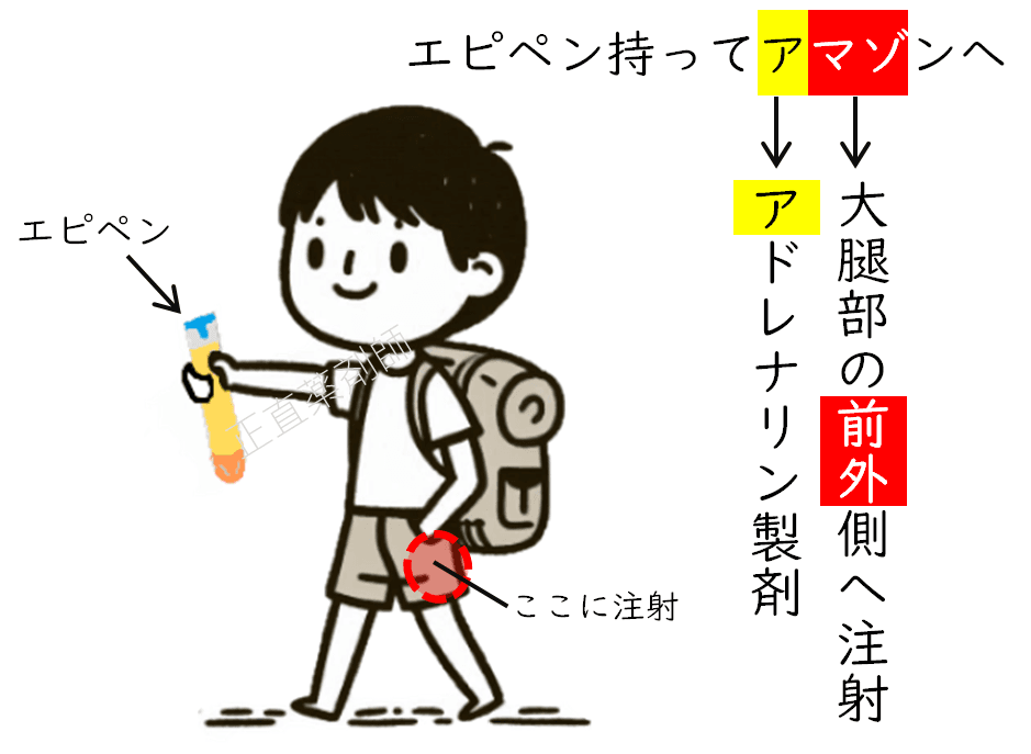 エピペンの使い方を語呂合わせで覚えるためのイラスト。アドレナリン製剤（ア）、注射部位（前外側）の位置（マゾ）を示す。
