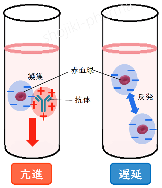赤沈の亢進と遅延を表す図。亢進時は赤血球が免疫グロブリンと凝集し沈降が速くなる様子、遅延時は赤血球同士が反発し沈降が遅くなる様子が対比的に描かれている。