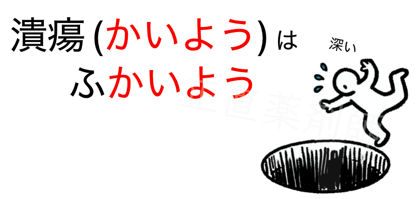 潰瘍（かいよう）は深いよう（かいよう）という語呂合わせで、びらんと潰瘍の違いを覚える方法を示したイラスト。潰瘍が粘膜の深い損傷であることを視覚的に表現。」