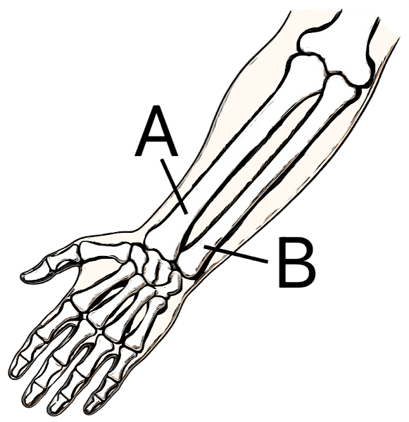 手描き風の橈骨と尺骨のイラスト。前腕の2本の骨がシンプルに描かれている。