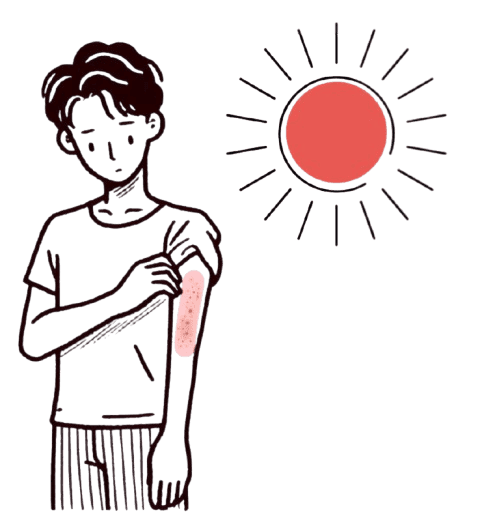 湿布薬を貼っていた上腕に日光が当たり、赤くかぶれて光線過敏症になった男性のイラスト。